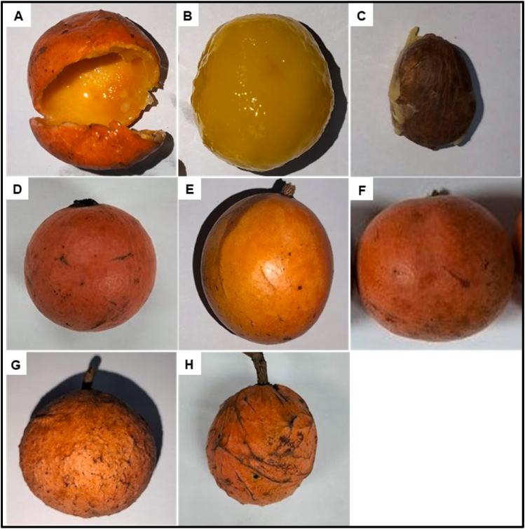 https://cdn.ncbi.nlm.nih.gov/pmc/blobs/bbdb/10884428/62ab14c8b034/gr5.jpg