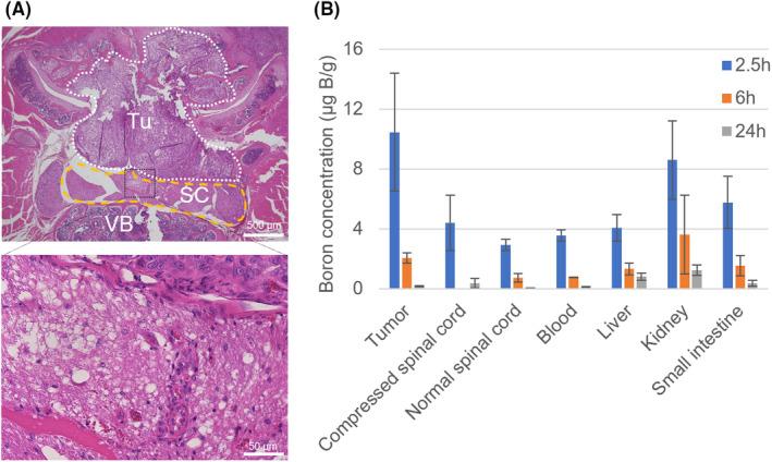 https://cdn.ncbi.nlm.nih.gov/pmc/blobs/bbdb/11309935/807bf7e261a0/CAS-115-2774-g004.jpg