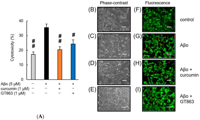 https://cdn.ncbi.nlm.nih.gov/pmc/blobs/bbdf/9960433/f860e98c3877/ijms-24-03089-g004.jpg