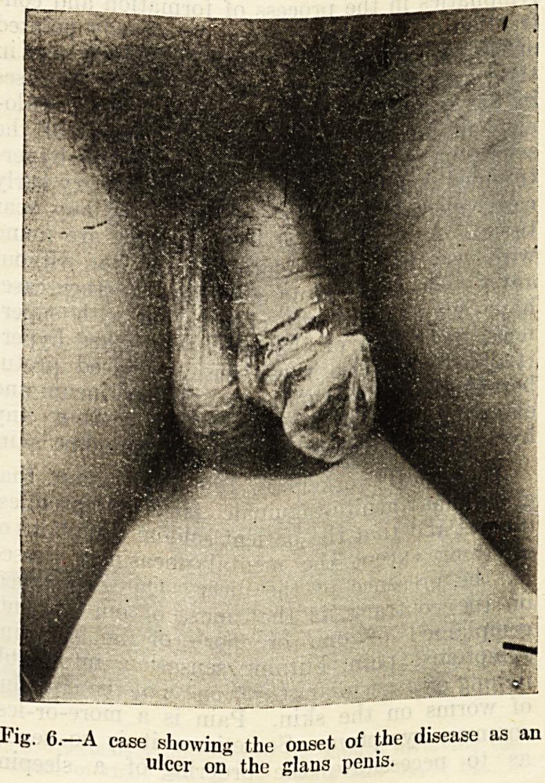 https://cdn.ncbi.nlm.nih.gov/pmc/blobs/bbe6/5159014/74b5b8042e37/indmedgaz72273-0007-a.jpg