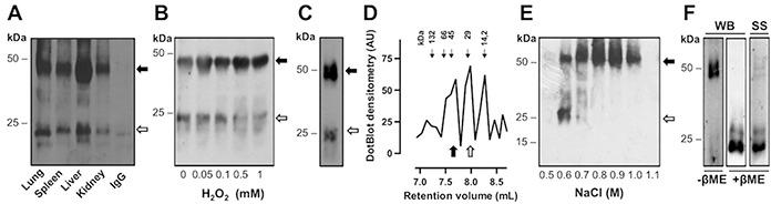 https://cdn.ncbi.nlm.nih.gov/pmc/blobs/bbed/5085234/06156d089014/oncotarget-07-35353-g001.jpg
