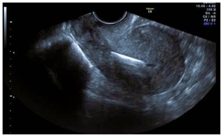 https://cdn.ncbi.nlm.nih.gov/pmc/blobs/bbf5/11534385/2eeb73a08e57/cm-97-477f2.jpg