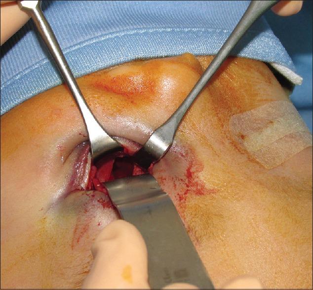 https://cdn.ncbi.nlm.nih.gov/pmc/blobs/bbf5/6933969/1b080eca6c8b/AMS-9-403-g003.jpg