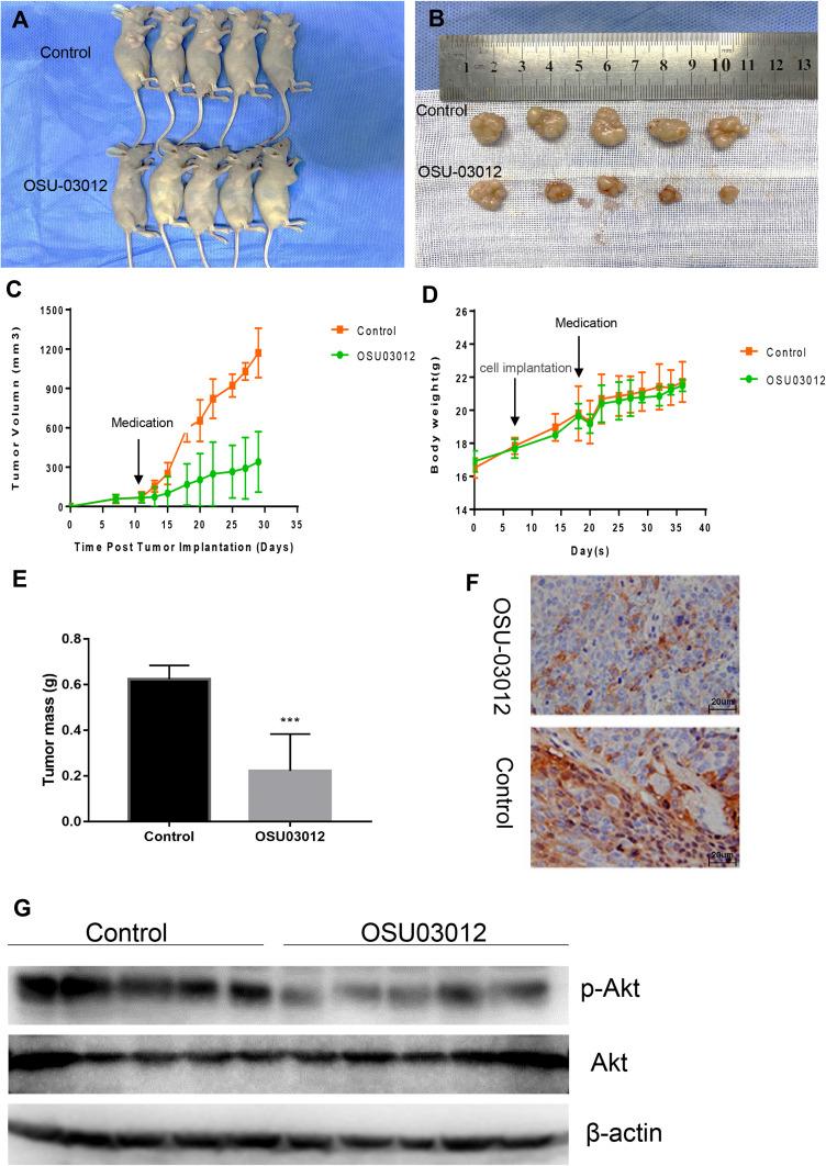 https://cdn.ncbi.nlm.nih.gov/pmc/blobs/bbf5/8096345/762890eeab6d/DDDT-15-1797-g0006.jpg