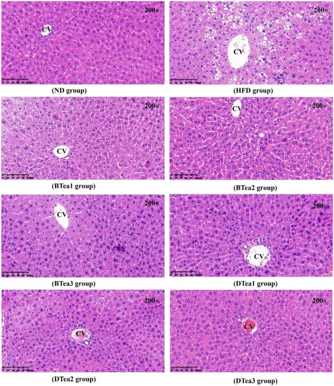 https://cdn.ncbi.nlm.nih.gov/pmc/blobs/bbff/9658379/6408d5f65c3f/foods-11-03457-g005.jpg