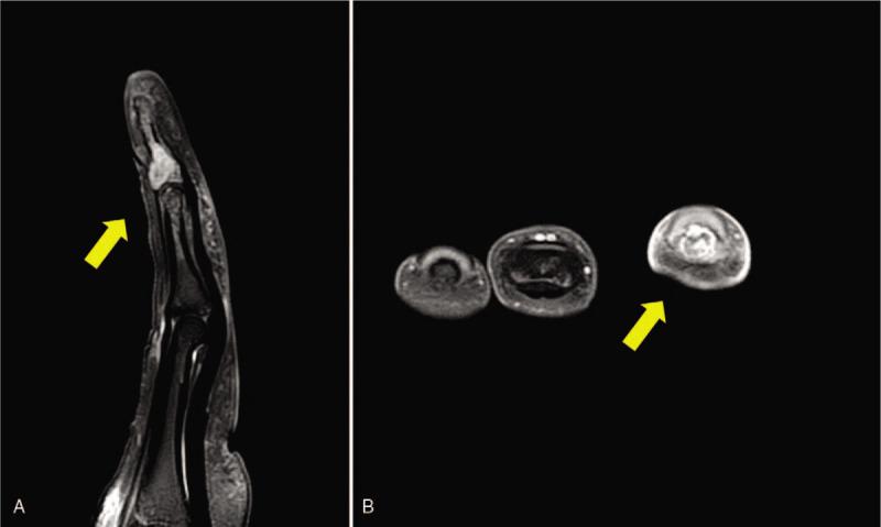 https://cdn.ncbi.nlm.nih.gov/pmc/blobs/bc07/12245313/69ec6a288547/medi-99-e20219-g003.jpg