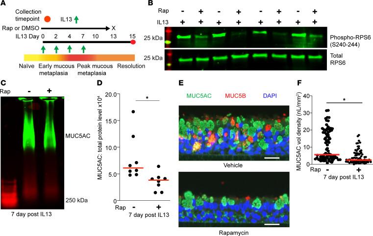 https://cdn.ncbi.nlm.nih.gov/pmc/blobs/bc08/12288895/7fa1a21c1888/jciinsight-10-187904-g102.jpg