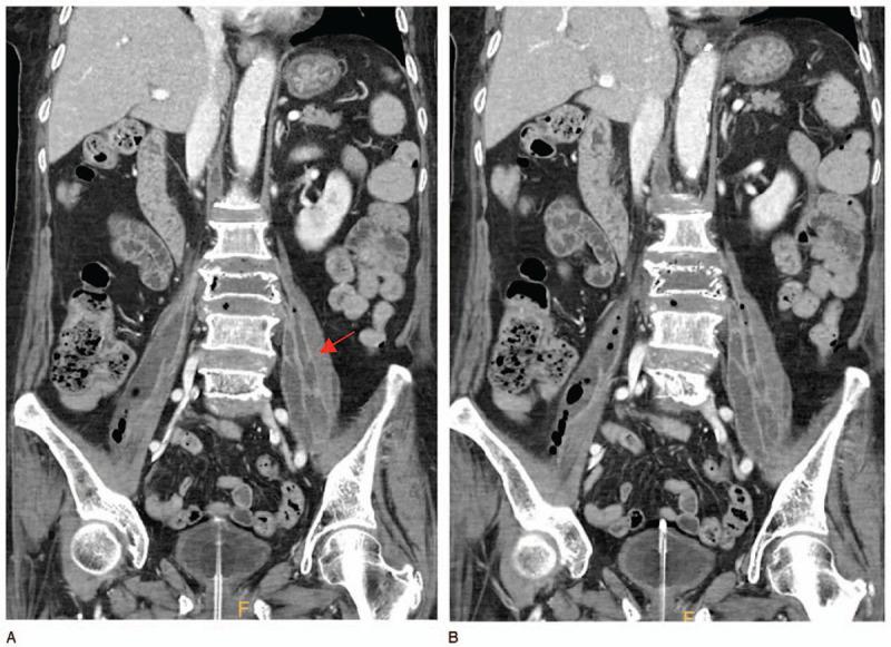 https://cdn.ncbi.nlm.nih.gov/pmc/blobs/bc13/7440240/d516d571f0f1/medi-99-e19640-g004.jpg