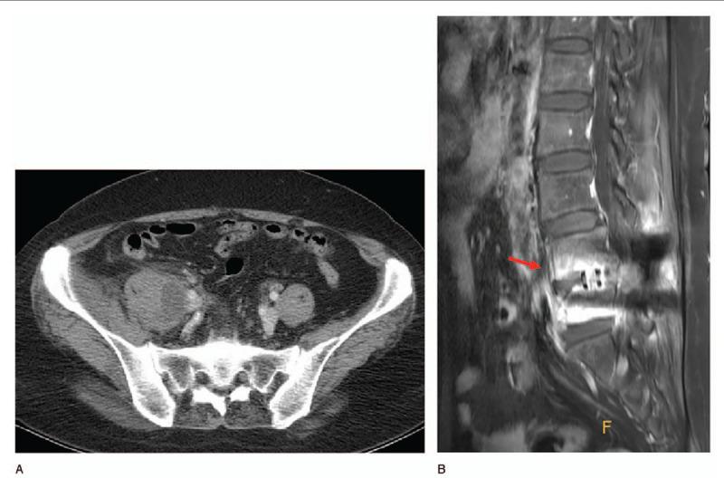 https://cdn.ncbi.nlm.nih.gov/pmc/blobs/bc13/7440240/fd794dbbc5c9/medi-99-e19640-g005.jpg