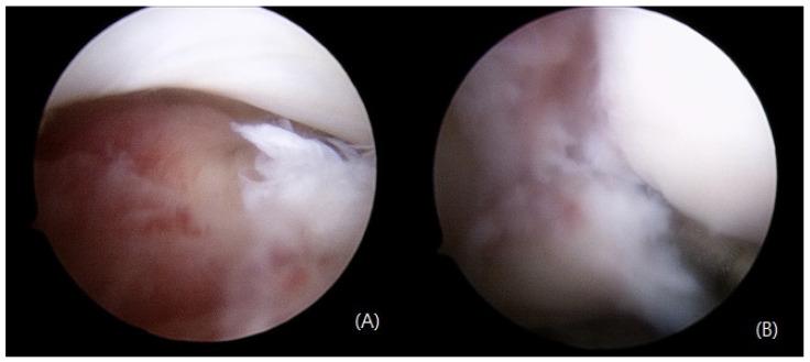 https://cdn.ncbi.nlm.nih.gov/pmc/blobs/bc15/10145241/ac0a9accb537/medicina-59-00652-g004.jpg