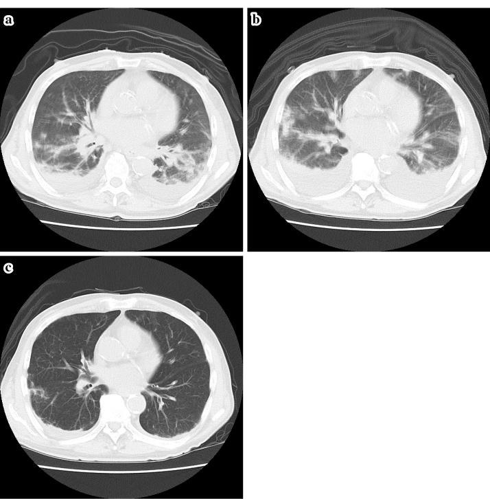 https://cdn.ncbi.nlm.nih.gov/pmc/blobs/bc1a/5109574/8db029d1240c/1349-7235-55-3029-g001.jpg
