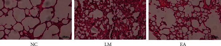 https://cdn.ncbi.nlm.nih.gov/pmc/blobs/bc1a/9613389/81872e4d5f5e/ECAM2022-8997173.002.jpg