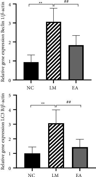 https://cdn.ncbi.nlm.nih.gov/pmc/blobs/bc1a/9613389/d25d136f6eb6/ECAM2022-8997173.004.jpg