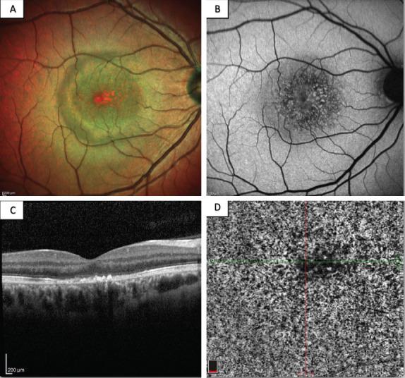 https://cdn.ncbi.nlm.nih.gov/pmc/blobs/bc20/11372403/78bf4e860d56/BEJ-9-165-g003.jpg