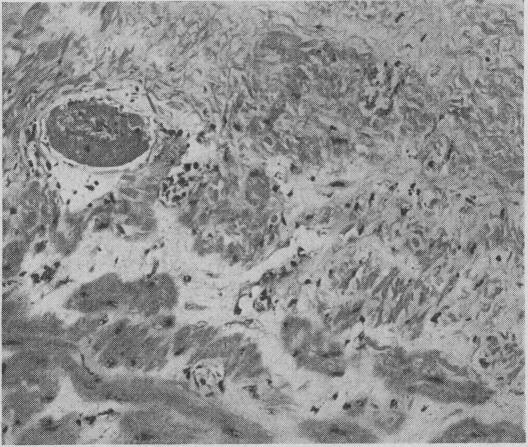 https://cdn.ncbi.nlm.nih.gov/pmc/blobs/bc26/1814976/8e619de035b2/brmedj02629-0056-a.jpg