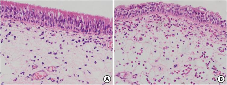 https://cdn.ncbi.nlm.nih.gov/pmc/blobs/bc2b/9880304/f0a2b83a194c/aair-15-67-g002.jpg