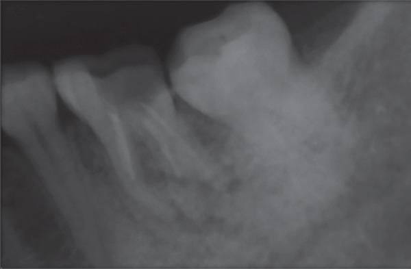 https://cdn.ncbi.nlm.nih.gov/pmc/blobs/bc2e/6611532/449b75e6d330/ijcpd-11-536-g001.jpg