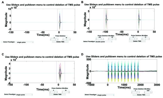 https://cdn.ncbi.nlm.nih.gov/pmc/blobs/bc3e/5054290/d382df7a41d0/fncir-10-00078-g0004.jpg