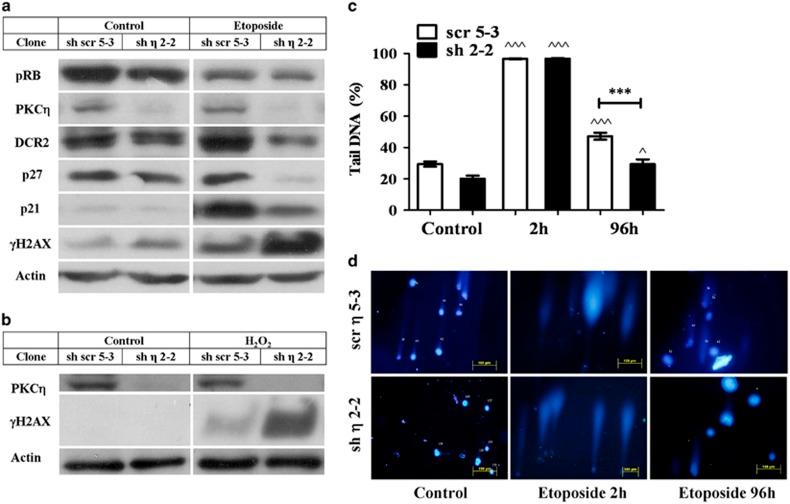 https://cdn.ncbi.nlm.nih.gov/pmc/blobs/bc44/4260739/d0ac7611b709/cddis2014481f2.jpg