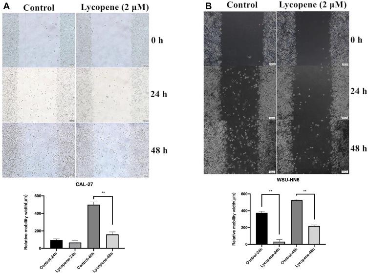 https://cdn.ncbi.nlm.nih.gov/pmc/blobs/bc46/7847369/149d0d7c4396/CMAR-13-723-g0002.jpg