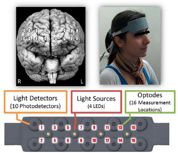 https://cdn.ncbi.nlm.nih.gov/pmc/blobs/bc49/10875049/5f8c8f5b9108/fnhum-18-1286918-g001.jpg