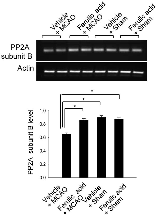 https://cdn.ncbi.nlm.nih.gov/pmc/blobs/bc4d/3547913/5dec1a4d8f35/pone.0054217.g003.jpg