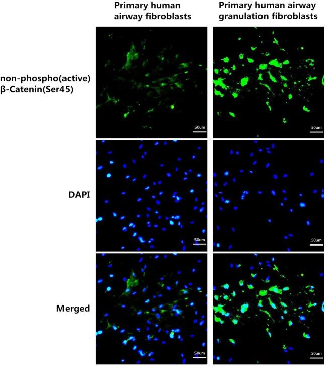 https://cdn.ncbi.nlm.nih.gov/pmc/blobs/bc4d/5835718/ee5a5805a425/bsr-38-bsr20171386-g2.jpg