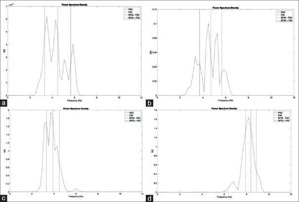 https://cdn.ncbi.nlm.nih.gov/pmc/blobs/bc4d/5992899/9c3db912dd2f/JMSS-8-65-g008.jpg