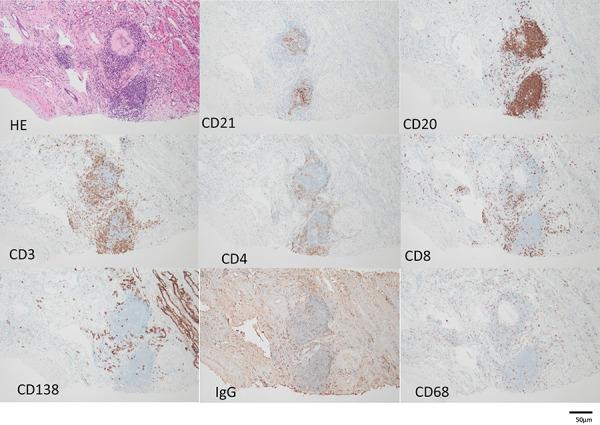 https://cdn.ncbi.nlm.nih.gov/pmc/blobs/bc59/11706227/2e5d3683c120/CNCS-12-073-02i.jpg