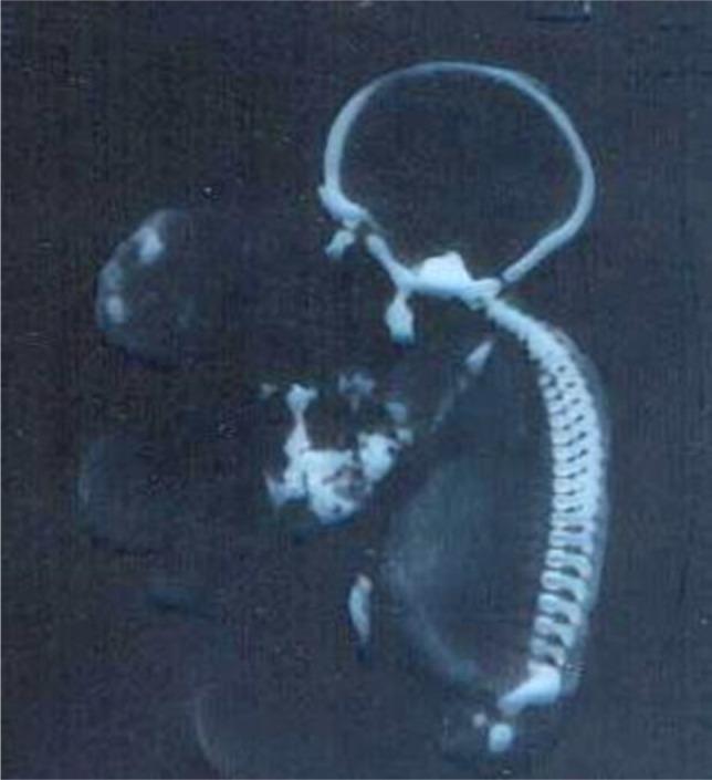 https://cdn.ncbi.nlm.nih.gov/pmc/blobs/bc5c/7550148/2ba263ba7799/JMedLife-13-435-g002.jpg
