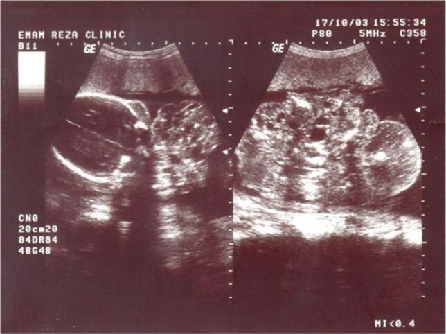 https://cdn.ncbi.nlm.nih.gov/pmc/blobs/bc5c/7550148/2e1df776f420/JMedLife-13-435-g001.jpg