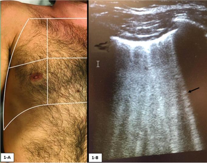 https://cdn.ncbi.nlm.nih.gov/pmc/blobs/bc64/6289153/399287f1e68c/emerg-6-e55-g001.jpg