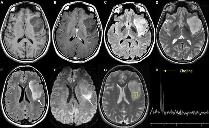 https://cdn.ncbi.nlm.nih.gov/pmc/blobs/bc64/8904563/ea79f038f245/fnins-16-787755-g003.jpg