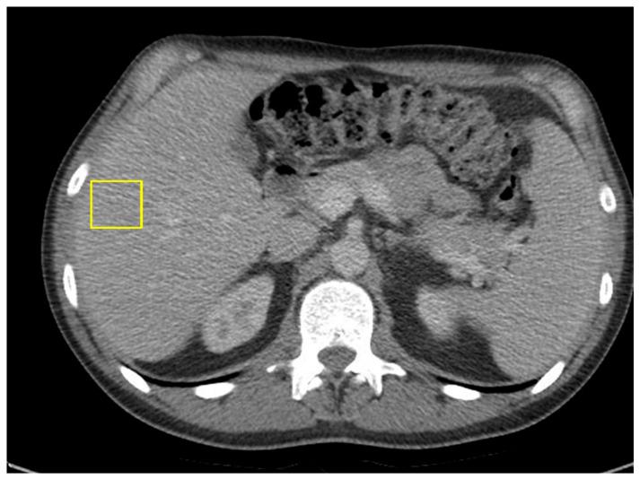 https://cdn.ncbi.nlm.nih.gov/pmc/blobs/bc65/12293316/58f8dc8e215c/curroncol-32-00370-g007.jpg