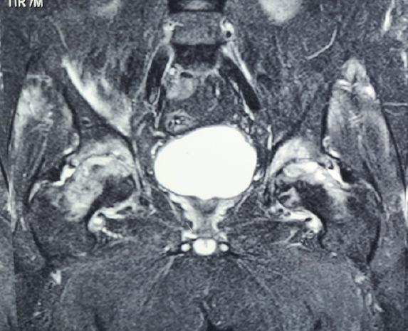 https://cdn.ncbi.nlm.nih.gov/pmc/blobs/bc6d/11823863/f0c508472925/JOCR-15-65-g002.jpg