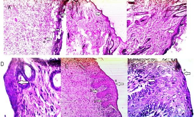 https://cdn.ncbi.nlm.nih.gov/pmc/blobs/bc76/3764671/11e7b499a3a1/JRPS-8-197-g004.jpg