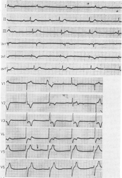 https://cdn.ncbi.nlm.nih.gov/pmc/blobs/bc7a/491236/bb880a8313f0/jnnpsyc00068-0103-a.jpg