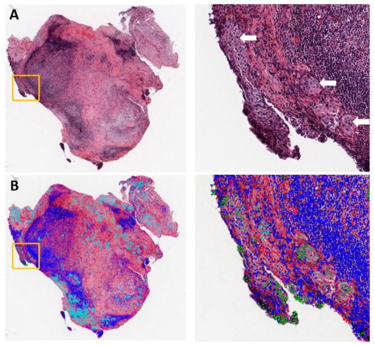 https://cdn.ncbi.nlm.nih.gov/pmc/blobs/bc85/6895901/76de1de8e7b0/cancers-11-01673-g001.jpg