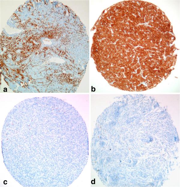 https://cdn.ncbi.nlm.nih.gov/pmc/blobs/bc89/3893364/019acfd7cd36/2051-5960-1-10-2.jpg