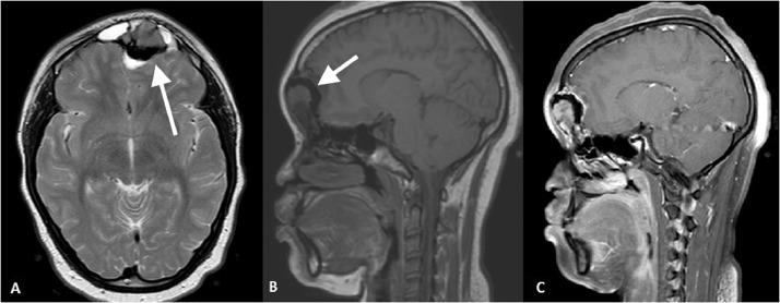 https://cdn.ncbi.nlm.nih.gov/pmc/blobs/bc8a/7214770/4667ce11f821/gr2.jpg