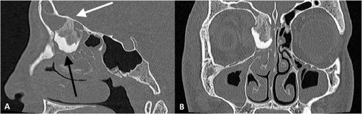 https://cdn.ncbi.nlm.nih.gov/pmc/blobs/bc8a/7214770/681dc60a7711/gr3.jpg