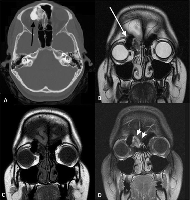 https://cdn.ncbi.nlm.nih.gov/pmc/blobs/bc8a/7214770/7c29275a10c4/gr5.jpg