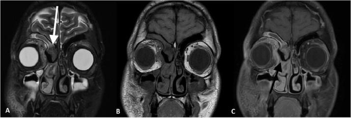 https://cdn.ncbi.nlm.nih.gov/pmc/blobs/bc8a/7214770/a65a71699309/gr4.jpg