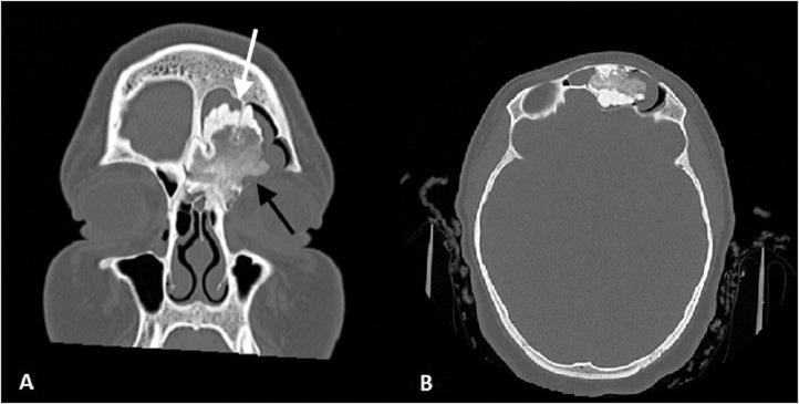 https://cdn.ncbi.nlm.nih.gov/pmc/blobs/bc8a/7214770/bf35a3efb3ac/gr1.jpg
