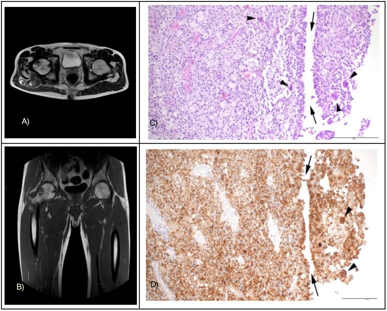 https://cdn.ncbi.nlm.nih.gov/pmc/blobs/bc8e/11464255/1a3090672734/fonc-14-1445427-g001.jpg