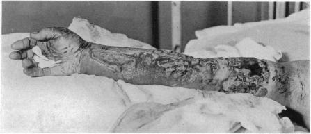 https://cdn.ncbi.nlm.nih.gov/pmc/blobs/bc90/1400264/d3e69bd5fbd9/annsurg00670-0143-a.jpg