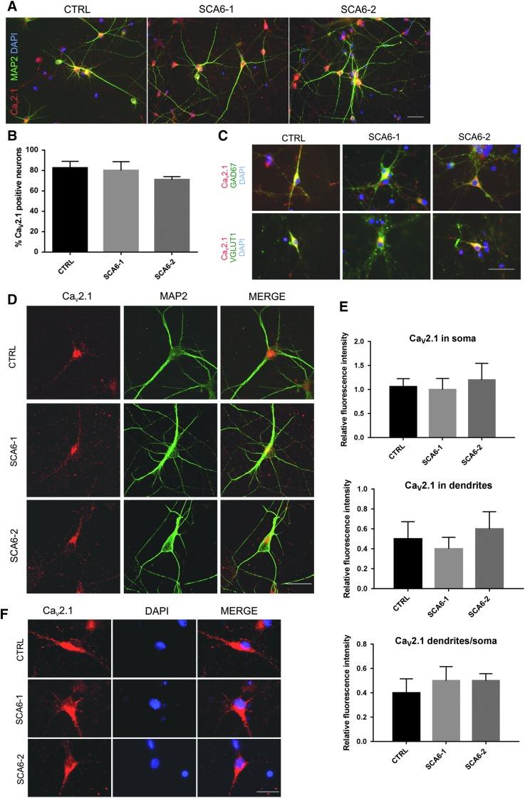 https://cdn.ncbi.nlm.nih.gov/pmc/blobs/bc98/5684673/6254198a13a1/fig-3.jpg