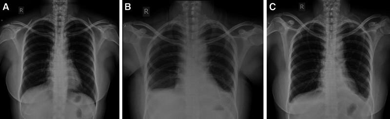 https://cdn.ncbi.nlm.nih.gov/pmc/blobs/bc9c/11556962/292b3030abe8/medi-103-e40371-g006.jpg