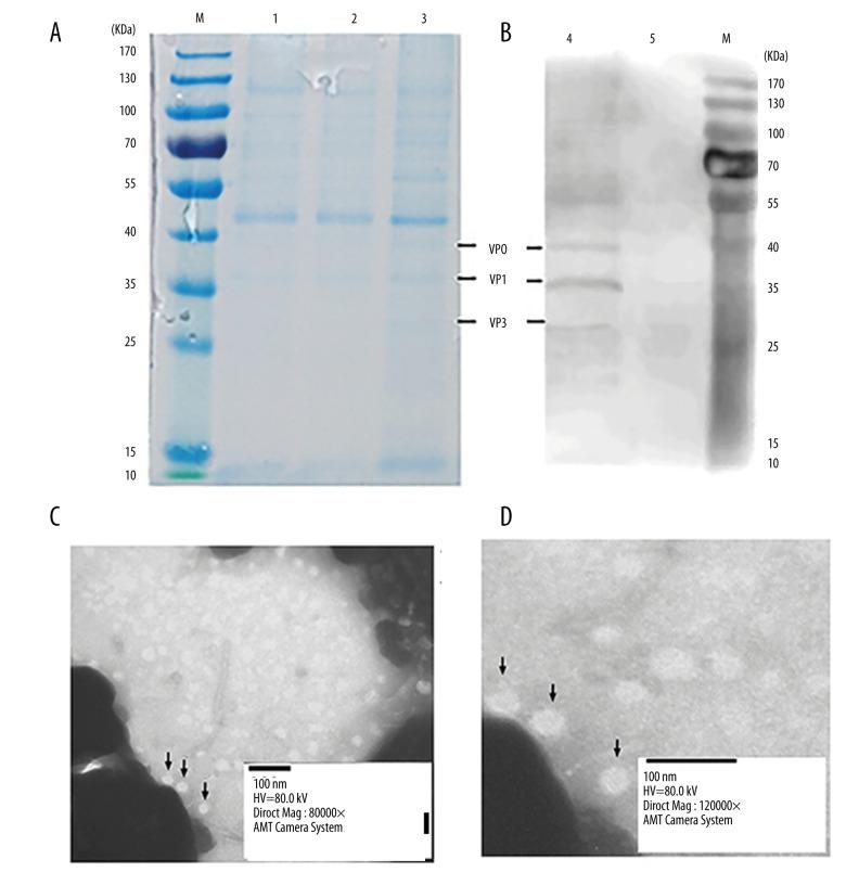 https://cdn.ncbi.nlm.nih.gov/pmc/blobs/bca3/5036384/9aa2f96249e9/medscimonit-22-3370-g002.jpg
