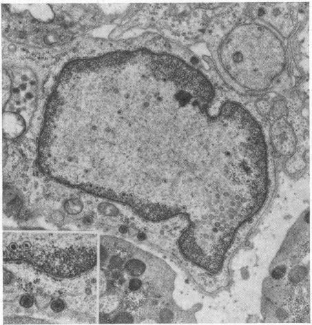 https://cdn.ncbi.nlm.nih.gov/pmc/blobs/bca5/1502977/eb78ae3bf148/califmed00041-0072-a.jpg